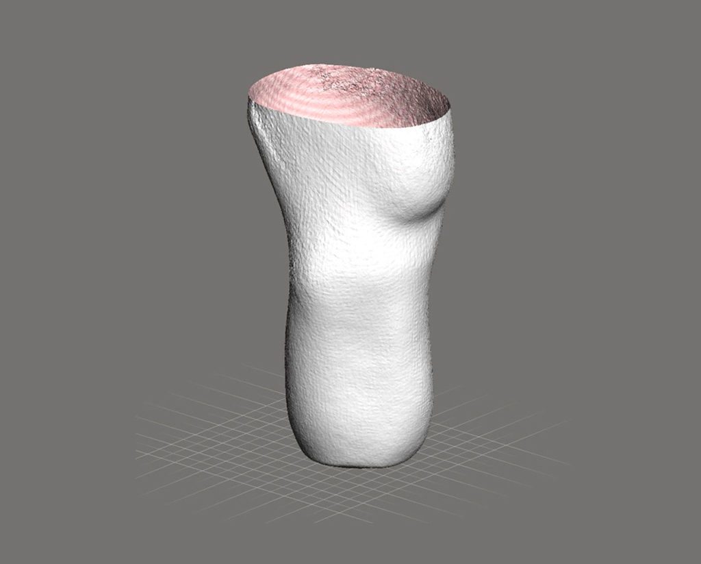 Digital Step2 Digital-limb_step2_2x | LIM Innovations